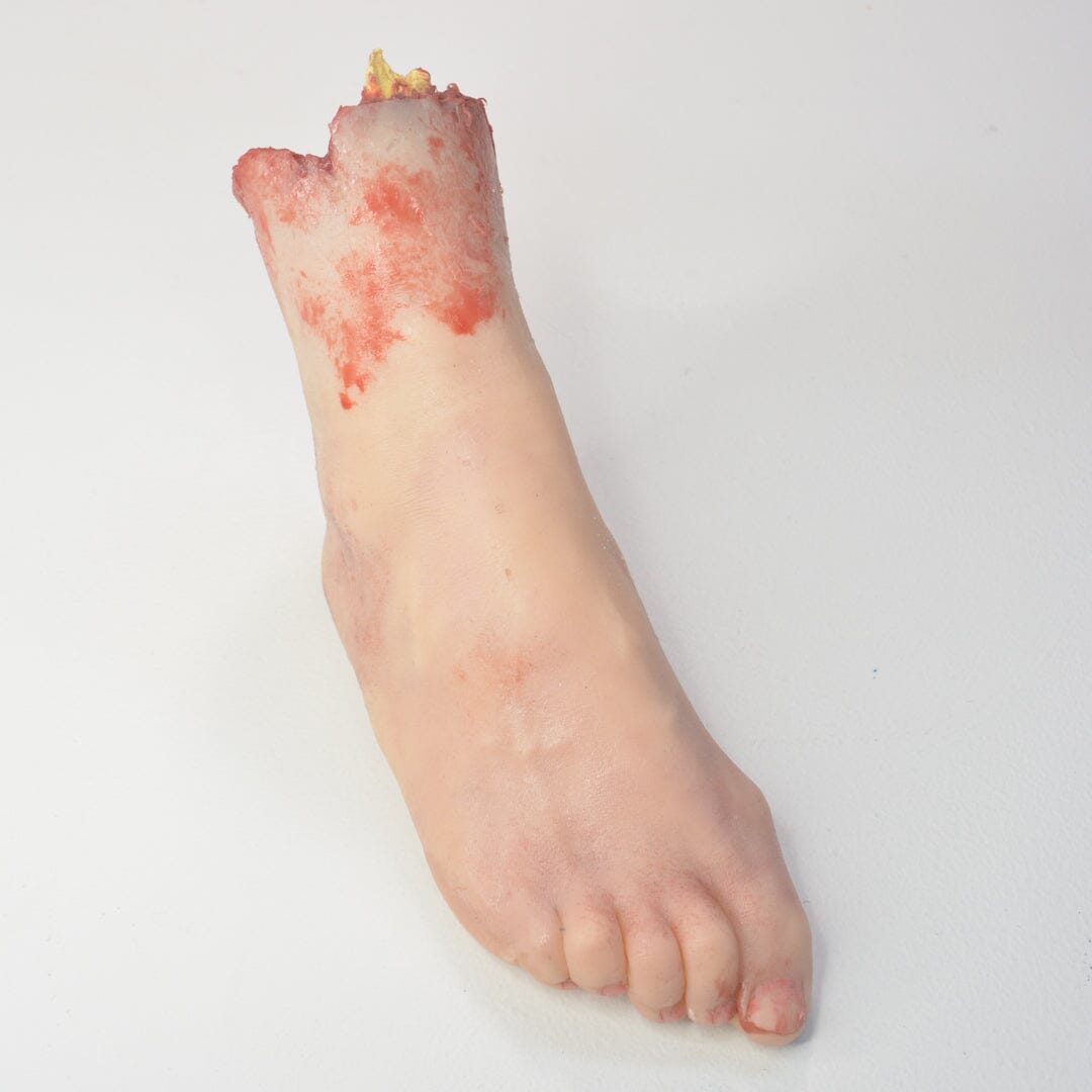 Amputated Foot