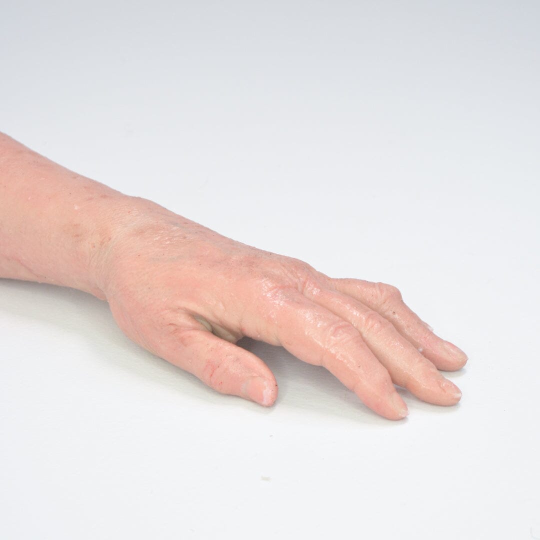 Elderly Arm