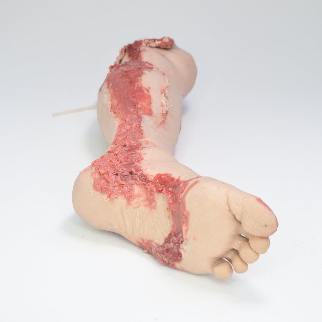 Mutilated Leg